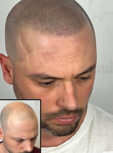 whatsapp image 2026 02 10 at 13 le upscale prime tone enhance 30(2)(1)